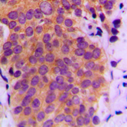 Anti-SEK1 / MKK4 (phospho Ser80) antibody used in IHC (Paraffin sections) (IHC-P). GTX55115