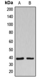 Anti-B3GALT1 antibody used in Western Blot (WB). GTX55180