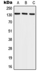 Anti-RECQL4 antibody used in Western Blot (WB). GTX55183