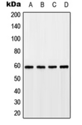 Anti-GPR75 antibody used in Western Blot (WB). GTX55193