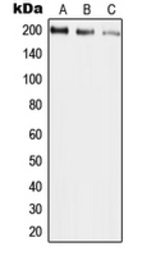 Anti-UBR2 antibody used in Western Blot (WB). GTX55219