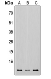 Anti-Osteocalcin antibody used in Western Blot (WB). GTX55255