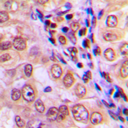 Anti-MEKK4 antibody used in IHC (Paraffin sections) (IHC-P). GTX55270