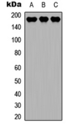 Anti-MEKK4 antibody used in Western Blot (WB). GTX55270