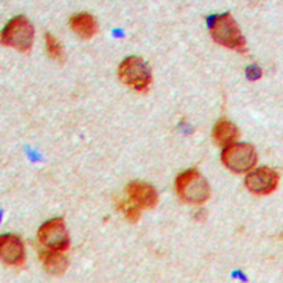 Anti-KDELR2 antibody used in IHC (Paraffin sections) (IHC-P). GTX55288