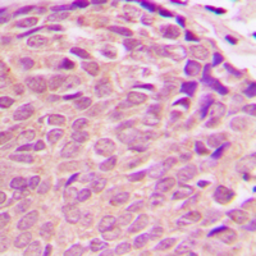 Anti-PDK2 antibody used in IHC (Paraffin sections) (IHC-P). GTX55290