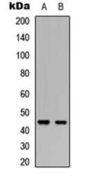 Anti-PDK2 antibody used in Western Blot (WB). GTX55290