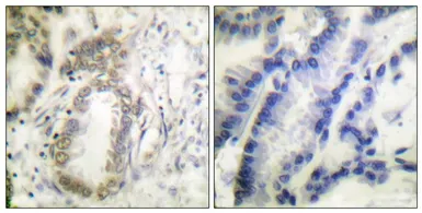 Anti-C/EBP alpha (phospho Ser21) antibody used in IHC (Paraffin sections) (IHC-P). GTX55304