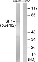 Anti-Splicing factor 1 (phospho Ser82) antibody used in Western Blot (WB). GTX55309