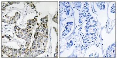 Anti-BLK (phospho Tyr501) antibody used in IHC (Paraffin sections) (IHC-P). GTX55328