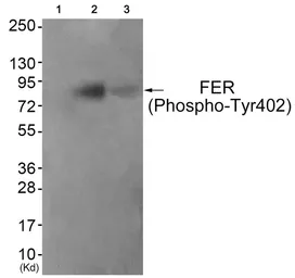Anti-FER (phospho Tyr402) antibody used in Western Blot (WB). GTX55330