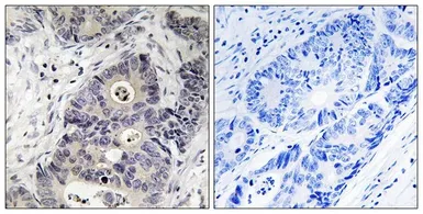 Anti-iNOS (phospho Tyr151) antibody used in IHC (Paraffin sections) (IHC-P). GTX55338