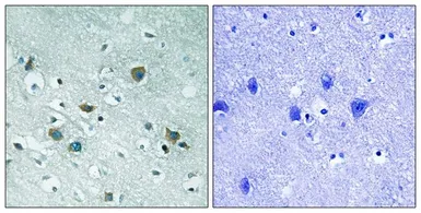 Anti-CRMP2 (phospho Thr509) antibody used in IHC (Paraffin sections) (IHC-P). GTX55355