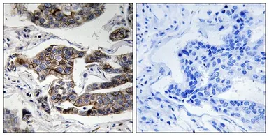 Anti-Girdin (phospho Ser1417) antibody used in IHC (Paraffin sections) (IHC-P). GTX55363