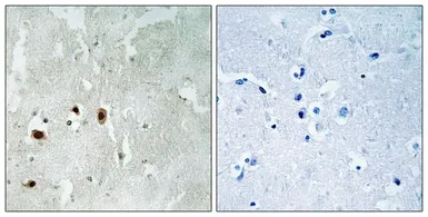 Anti-TIP60 (phospho Ser90) antibody used in IHC (Paraffin sections) (IHC-P). GTX55370