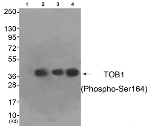 Anti-TOB1 (phospho Ser164) antibody used in Western Blot (WB). GTX55371