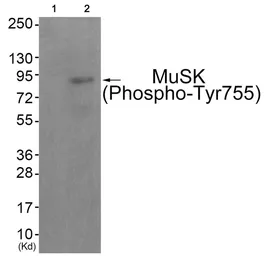 Anti-MUSK (phospho Tyr755) antibody used in Western Blot (WB). GTX55379