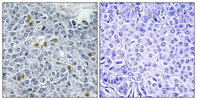 Anti-Topoisomerase II alpha (phospho Ser1106) antibody used in IHC (Paraffin sections) (IHC-P). GTX55437