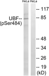 Anti-UBTF (phospho Ser484) antibody used in Western Blot (WB). GTX55450