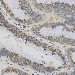 Anti-Histone H3K4me3 (Tri-methyl Lys4) antibody used in IHC (Paraffin sections) (IHC-P). GTX55482