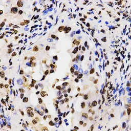 Anti-Histone H3R17me2 (di-methyl Arg17) antibody used in IHC (Paraffin sections) (IHC-P). GTX55484