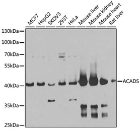 Anti-ACADS antibody used in Western Blot (WB). GTX55489