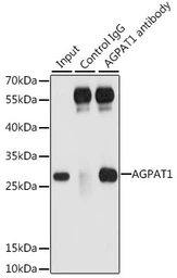 Anti-AGPAT1 antibody used in Immunoprecipitation (IP). GTX55496