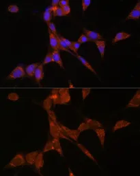 Anti-AKR1C3 antibody used in Immunocytochemistry/ Immunofluorescence (ICC/IF). GTX55499