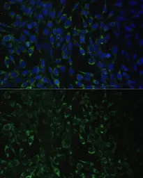 Anti-ALDH1A2 antibody used in Immunocytochemistry/ Immunofluorescence (ICC/IF). GTX55501