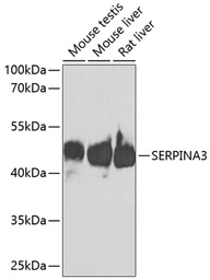 Anti-alpha 1 Antichymotrypsin antibody used in Western Blot (WB). GTX55503