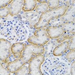 Anti-ARFGAP1 antibody used in IHC (Paraffin sections) (IHC-P). GTX55515