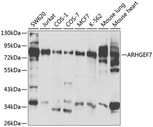 Anti-ARHGEF7 antibody used in Western Blot (WB). GTX55517
