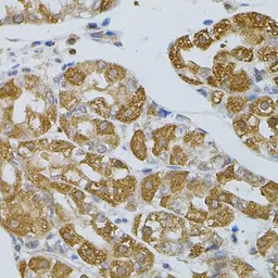 Anti-ASAH2 antibody used in IHC (Paraffin sections) (IHC-P). GTX55519