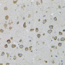 Anti-ASAH2 antibody used in IHC (Paraffin sections) (IHC-P). GTX55519