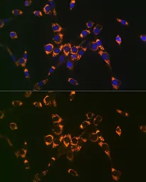 Anti-ASL antibody used in Immunocytochemistry/ Immunofluorescence (ICC/IF). GTX55520