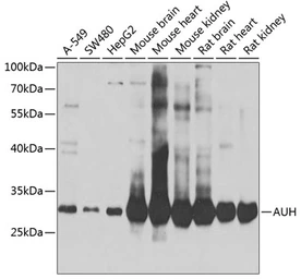 Anti-AUH antibody used in Western Blot (WB). GTX55527