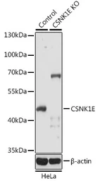 Anti-Casein Kinase 1 epsilon antibody used in Western Blot (WB). GTX55549