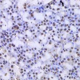 Anti-Casein Kinase 1 epsilon antibody used in IHC (Paraffin sections) (IHC-P). GTX55549