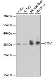 Anti-Cathepsin V antibody used in Western Blot (WB). GTX55550