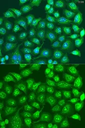 Anti-CCDC52 antibody used in Immunocytochemistry/ Immunofluorescence (ICC/IF). GTX55552
