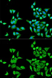 Anti-CES2 antibody used in Immunocytochemistry/ Immunofluorescence (ICC/IF). GTX55569