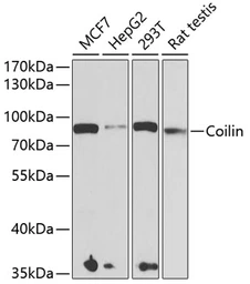 Anti-Coilin antibody used in Western Blot (WB). GTX55575