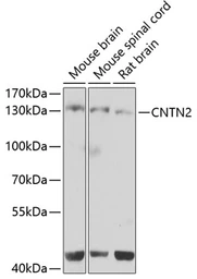 Anti-Contactin 2 antibody used in Western Blot (WB). GTX55577