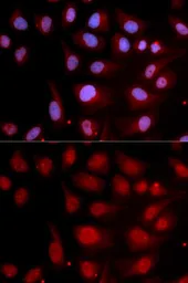 Anti-DNA polymerase beta antibody used in Immunocytochemistry/ Immunofluorescence (ICC/IF). GTX55594