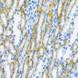 Anti-DNA polymerase beta antibody used in IHC (Paraffin sections) (IHC-P). GTX55594