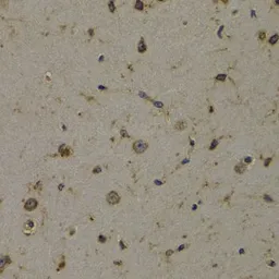 Anti-EEF1D antibody used in IHC (Paraffin sections) (IHC-P). GTX55601