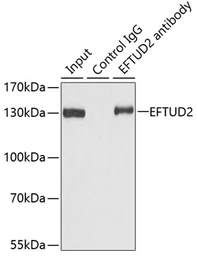 Anti-EFTUD2 antibody used in Immunoprecipitation (IP). GTX55602