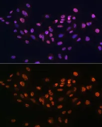 Anti-EFTUD2 antibody used in Immunocytochemistry/ Immunofluorescence (ICC/IF). GTX55602