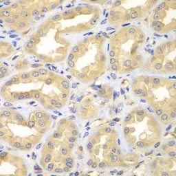 Anti-ELMO3 antibody used in IHC (Paraffin sections) (IHC-P). GTX55603