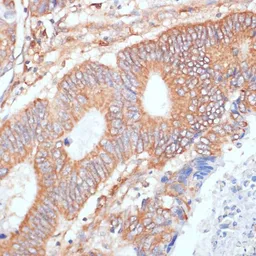 Anti-ENO1 antibody used in IHC (Paraffin sections) (IHC-P). GTX55604